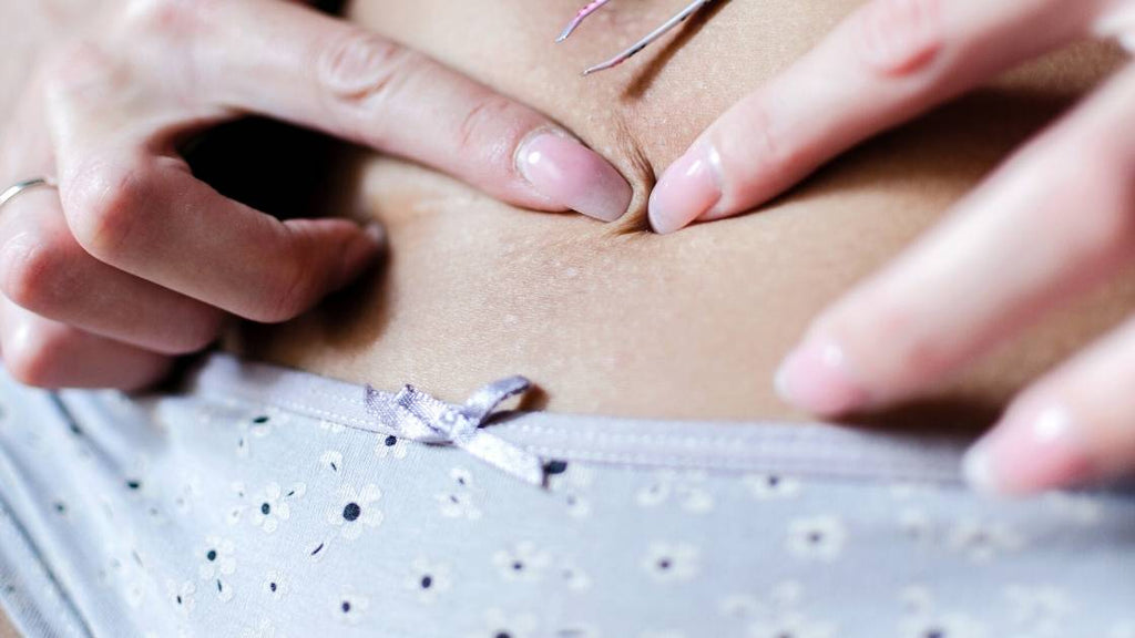 a woman with long nails trying to remove an ingrown hair in the bikini area on her stomach